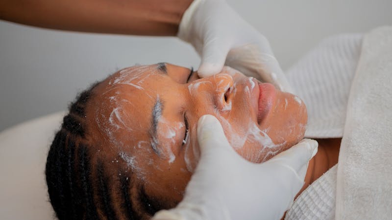Illustratie bij Glycolzuur Peeling: Werking, Resultaten en Thuisgebruik