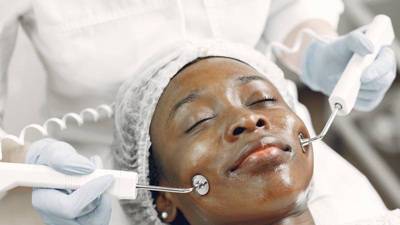 Illustratie bij Glycolzuur Peeling: Werking, Resultaten en Thuisgebruik